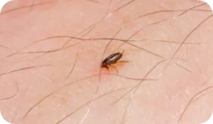 Désinsectisation - Puce